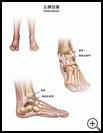 Thumbnail image of: Ankle Sprain: Illustration