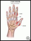 Thumbnail image of: Finger and Thumb Sprain: Illustration