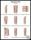 Thumbnail image of: Fractures: Illustration